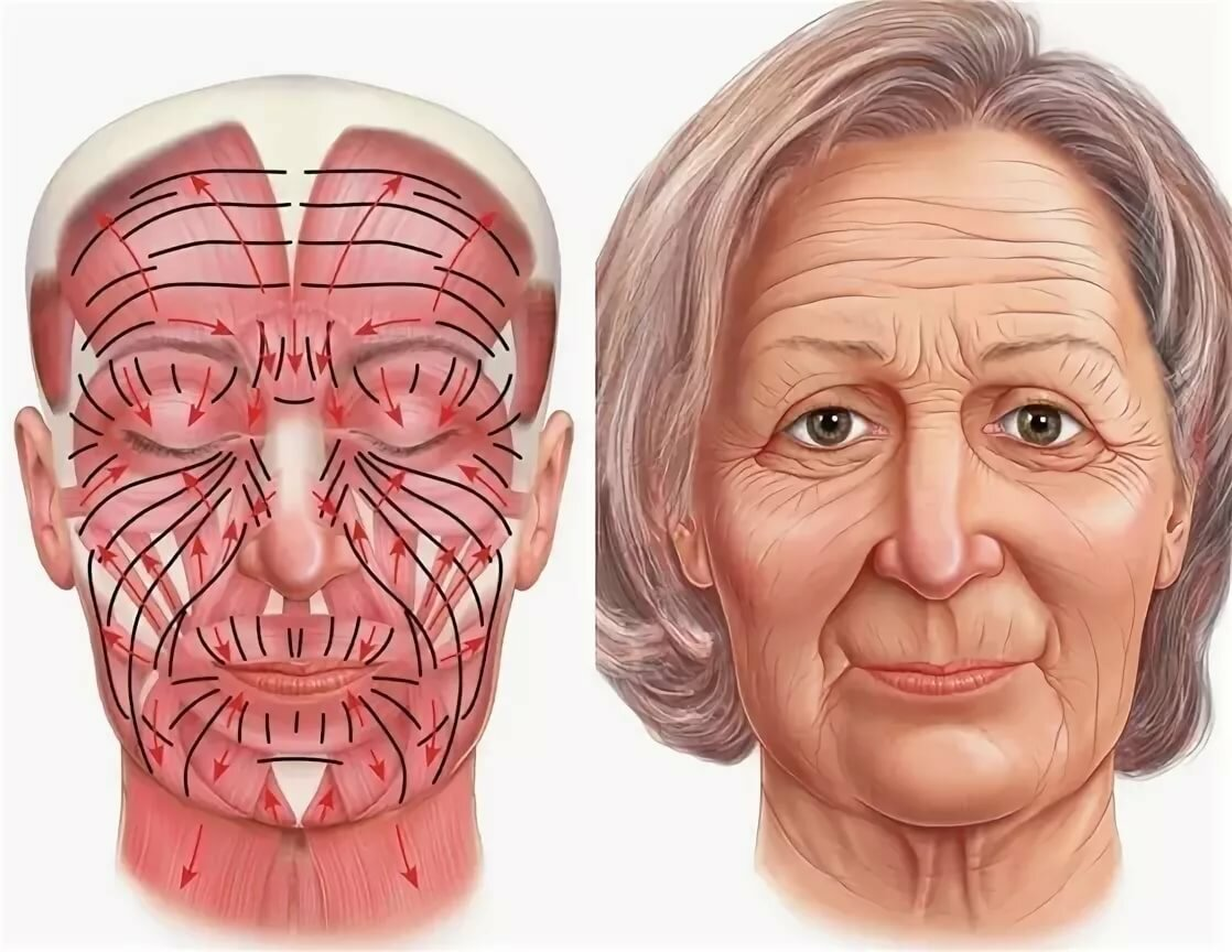 Косметология мышцы. Мышцы лица. Мышцы лица анатомия. Мимические морщины на лице. Мышцы лица и морщины.