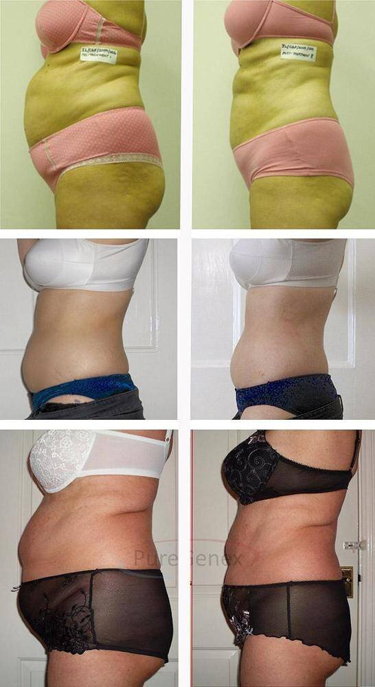 Фото из интернета. Первое слева в точности моя фигура сейчас. 