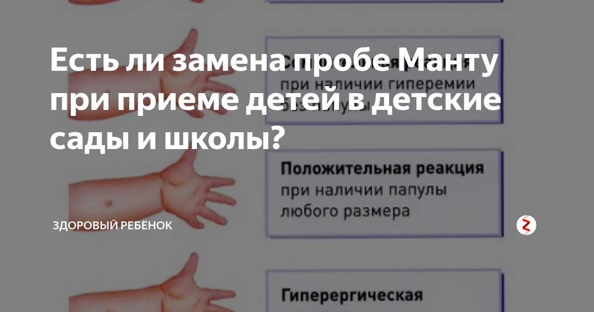 БЦЖ вместо Манту: какие есть риски для пострадавших детей и для страны в целом?