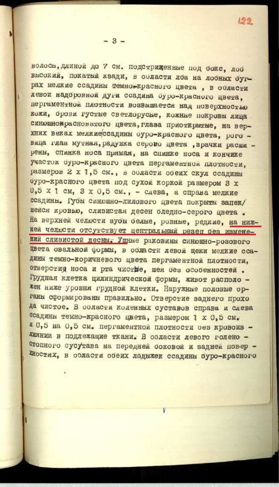 Лист дела из акта судебно-медицинского исследования трупа Дятлова 