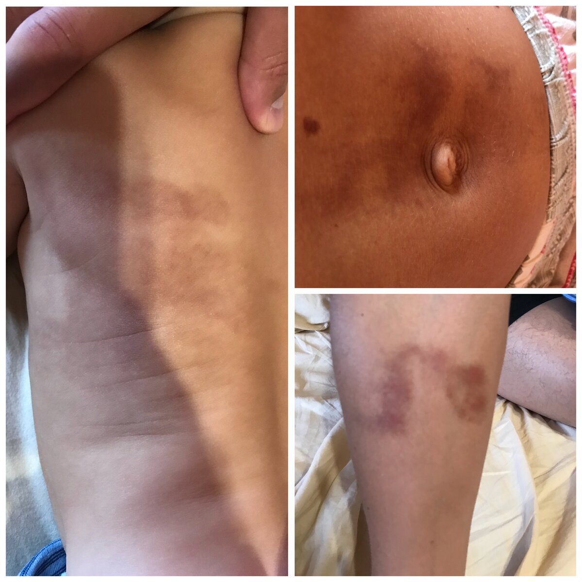 Слева на спинке четкие следы пальцев от руки, а спереди на плече след от большого пальца