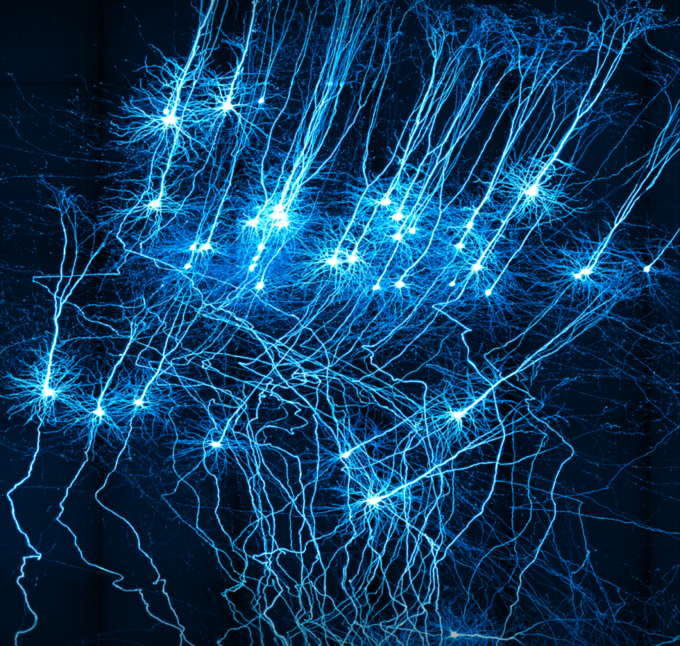 Нейронные клетки головного мозга. Нейрон в нейронной сети. Нейросеть Нейроны. Нейронные сети картинки. Клетки мозга виды