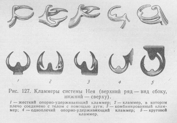 Бюгельные съемные протезы. Что это такое и «с чем их едят»?