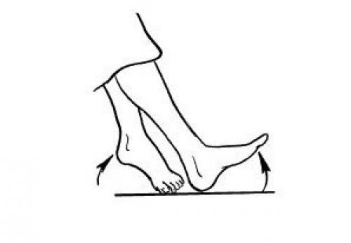 Фото взято из яндекс картинок