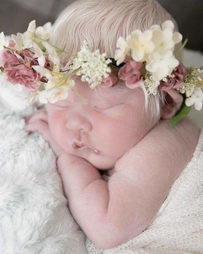 Девочка с розовой кожей и светлыми волосами