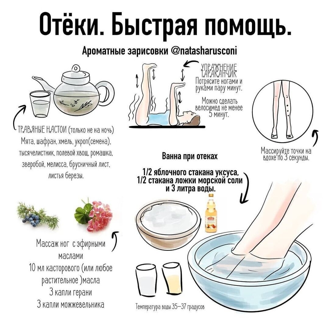 Что поможет при отеках. 