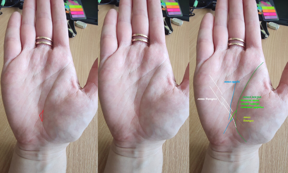 Что означает треугольник на линии жизни? | Хиромантия - заметки🔍🖐🏻 | Дзен