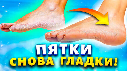 Download Video: Нежные пяточки цвета 