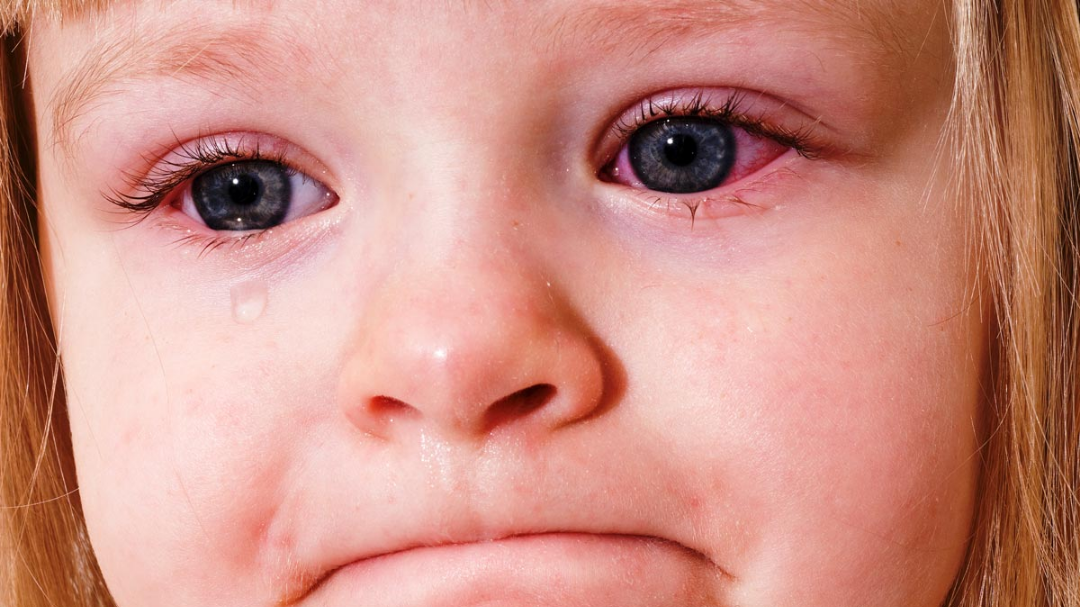 Своевременный поход к врачу обеспечит быстрое и правильное лечение, и снизит вероятность появления осложнений.