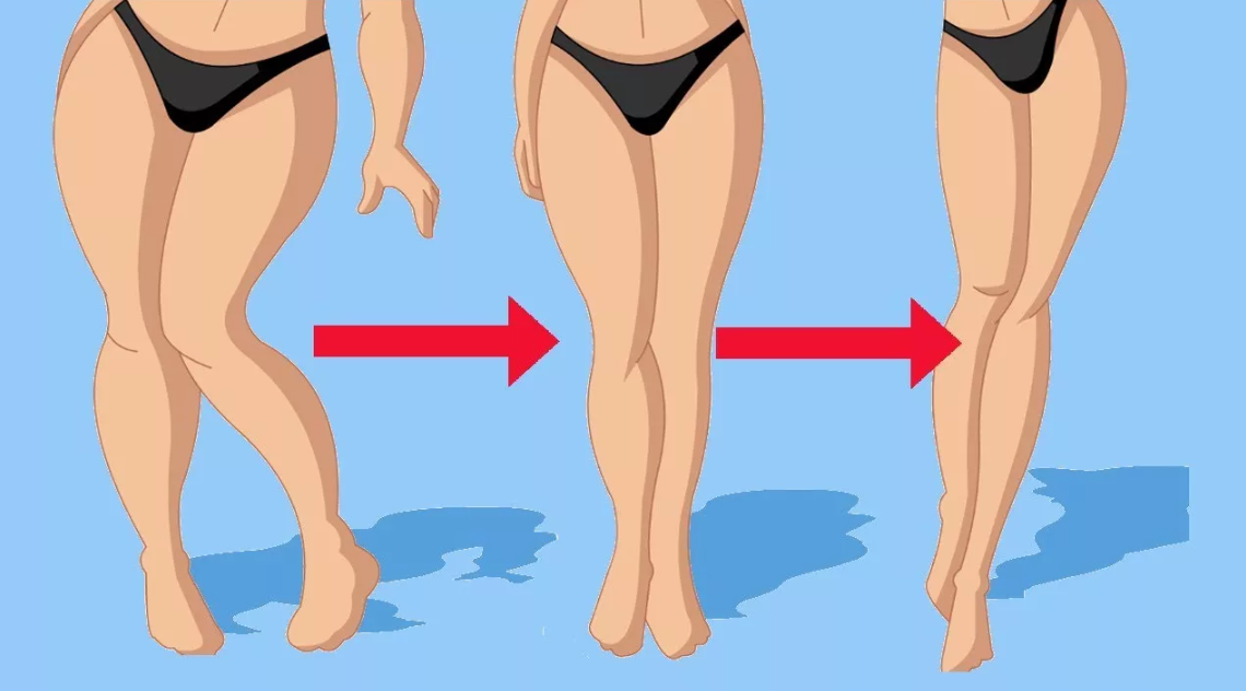 Полные ноги: как похудеть в ногах