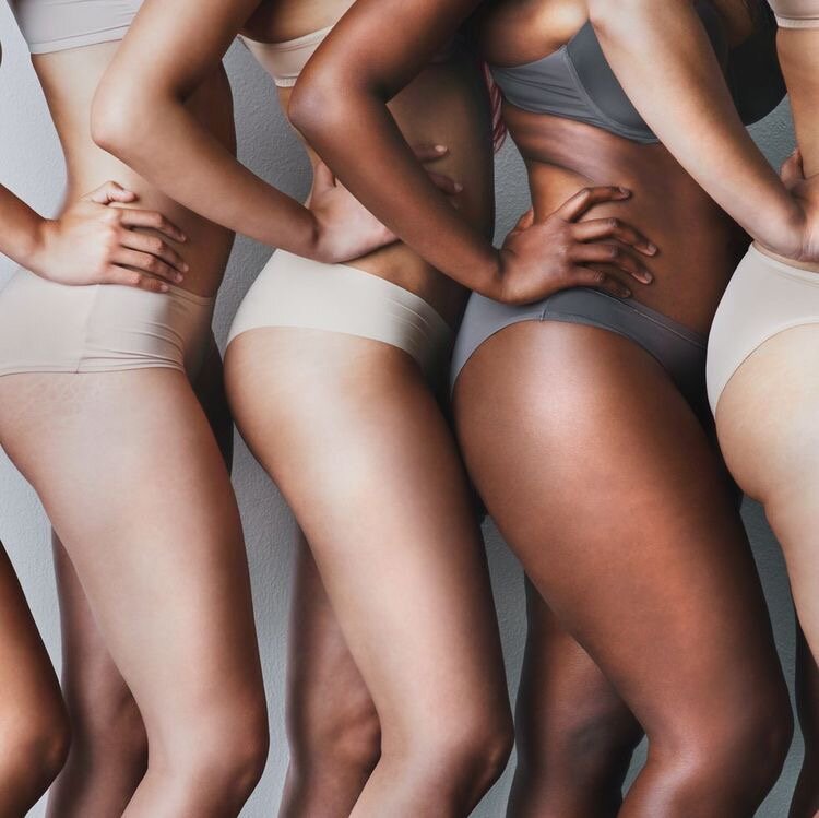 Целлюлит объединяет всех женщин