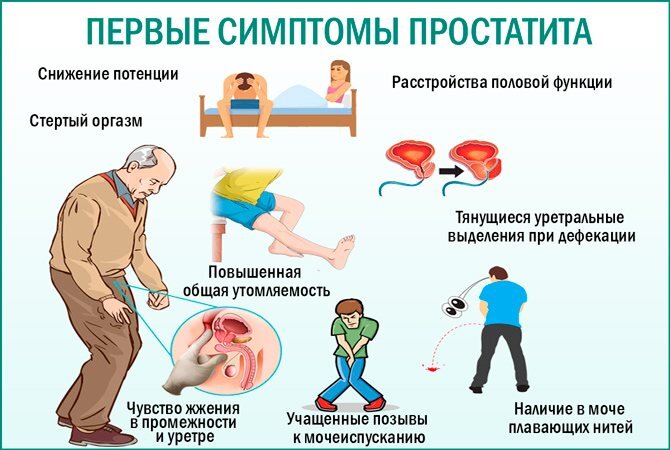 Необходимо обратить внимание на эти проявления, чтобы начать своевременно лечить простатит.