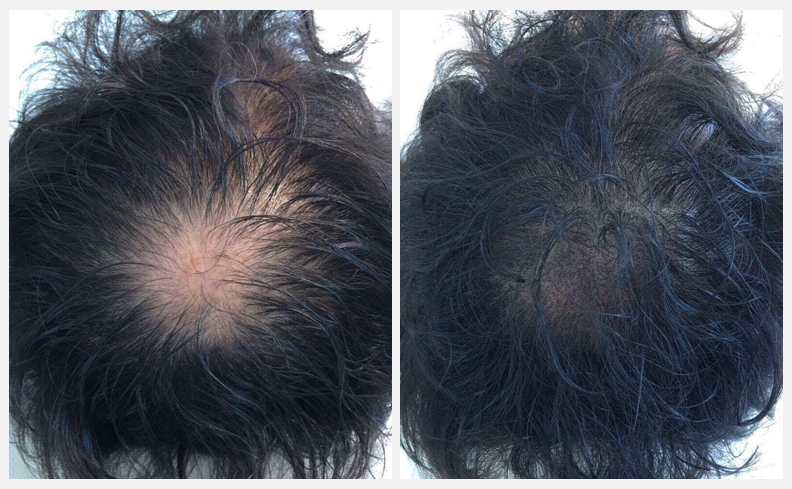 пример с волосами