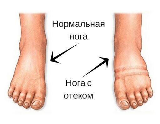 С просторов интернета