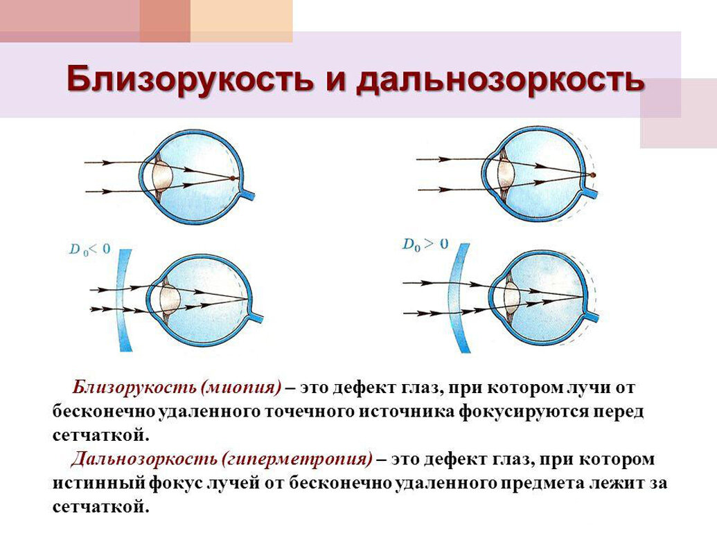 Рефракция при близорукости и дальнозоркости