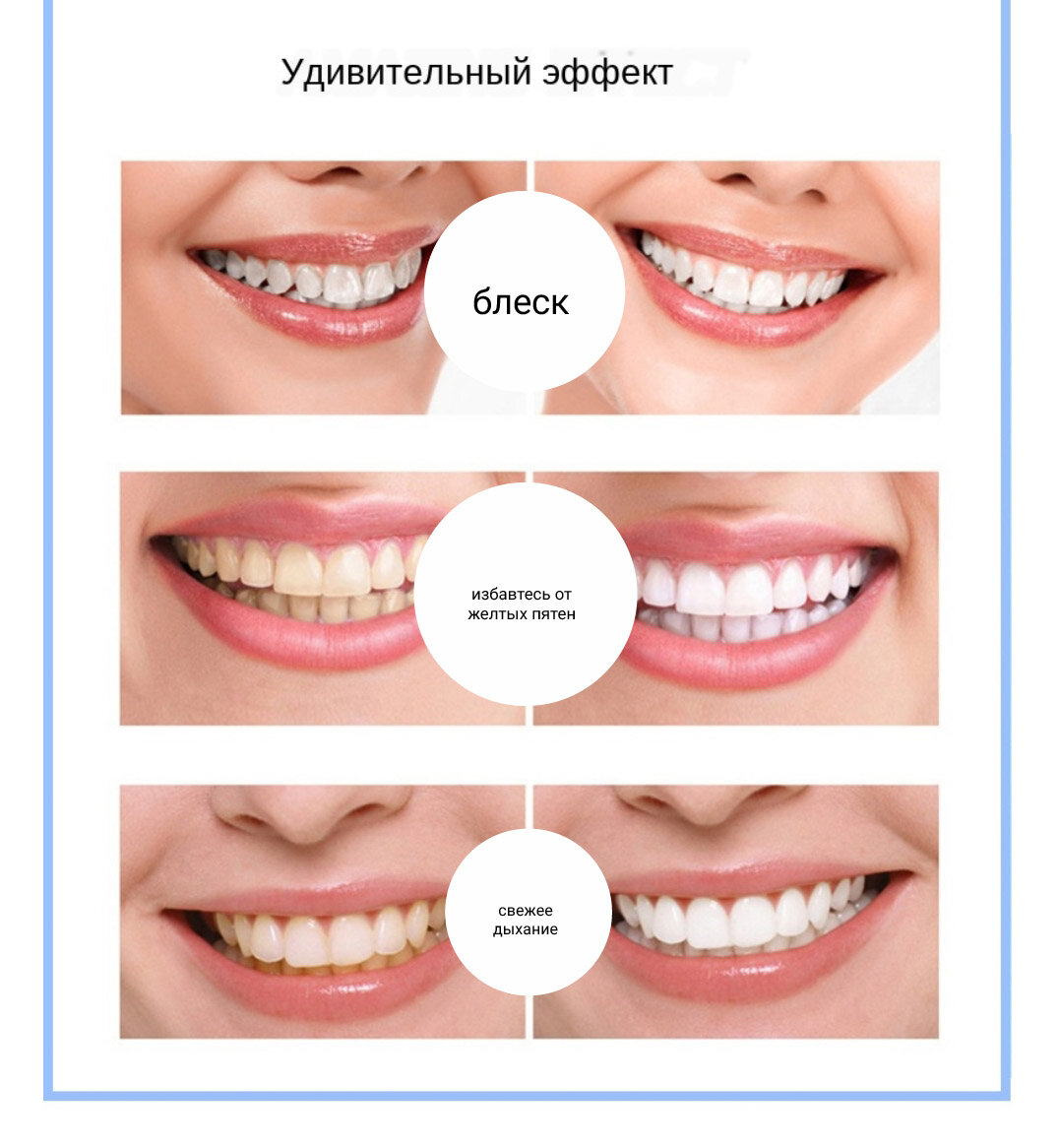 Как отбелить зубы в домашних условиях быстро и безопасно - FitoBlog