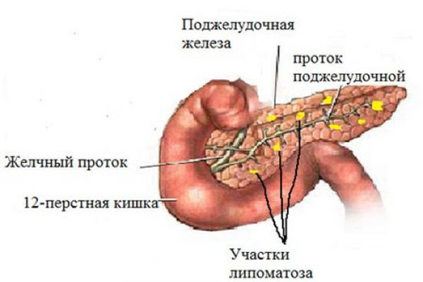 Источник фото: https://uzimaster.ru