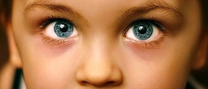 Эти дети смотрели не по детски пристально...