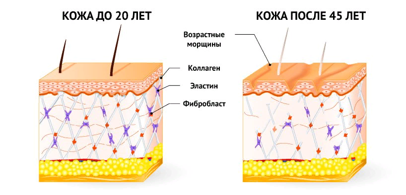 Коллаген - это каркас нашей кожи. Когда он разрушается, появляются морщины