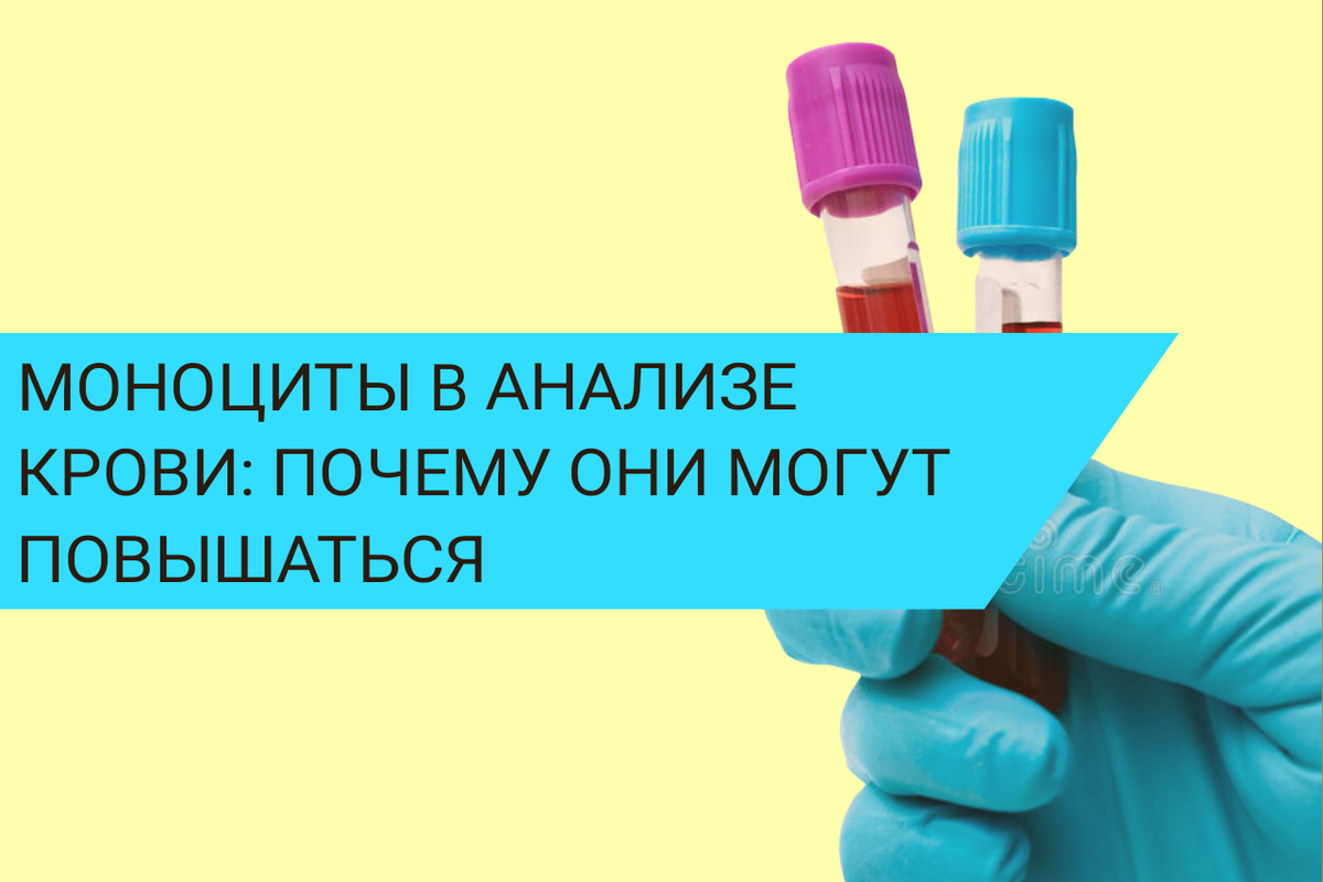 Моноцитоз в анализе крови. Какие болезни приводят к увеличению моноцитов в крови.