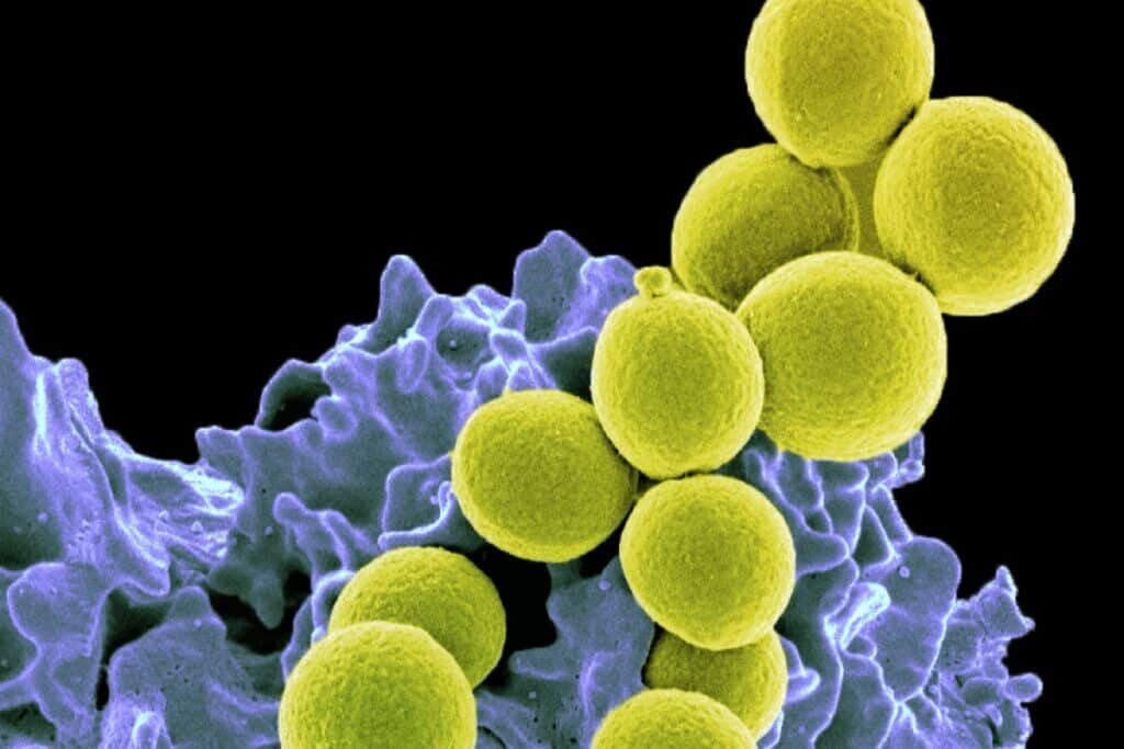    ©National Institute of Allergy and Infectious Diseases, NIH