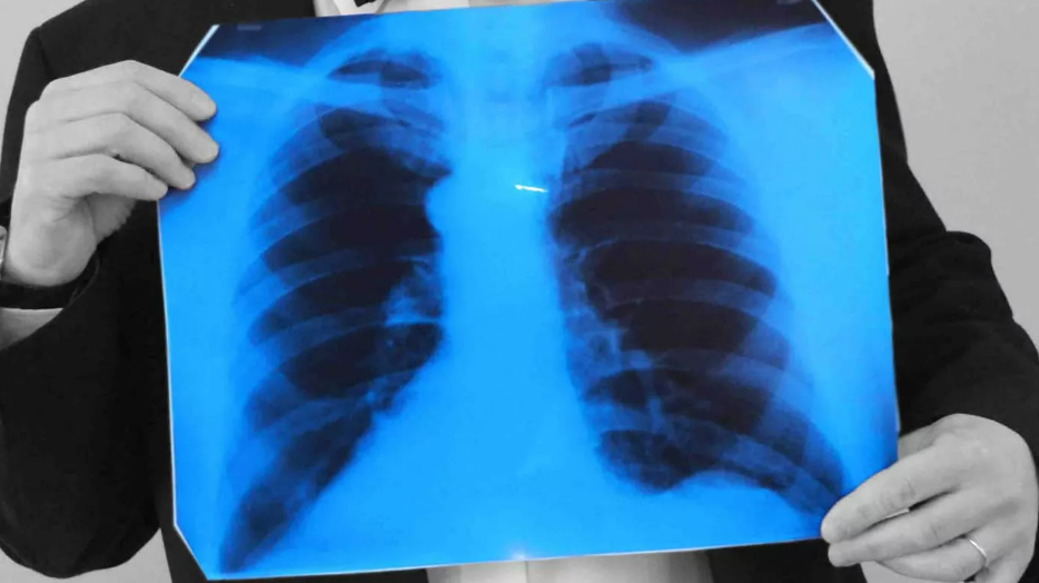 Фотография взята из источника upulmanologa.ru