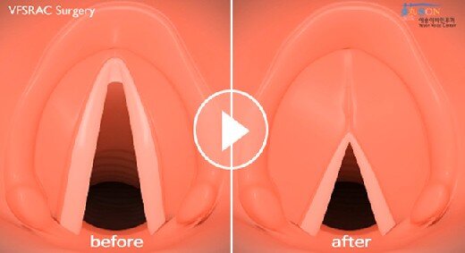 Источник: https://www.med2.ru/timg/160/113002520x520.jpg