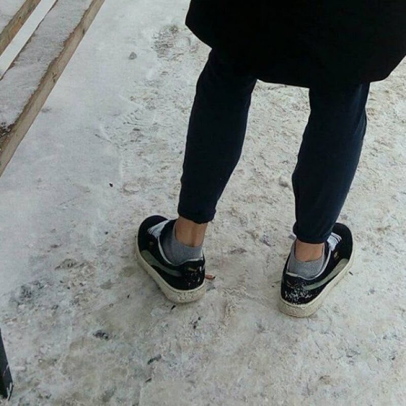 Щиколотный заяц