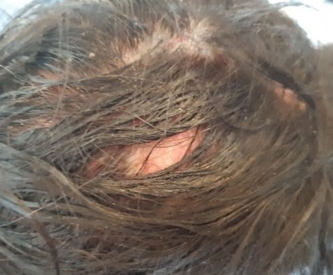 Фото взято из её открытых публикаций, которое она выложила в соц сеть 