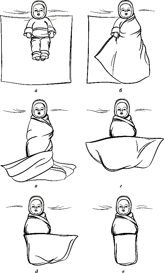 Один из вариантов пеленания 