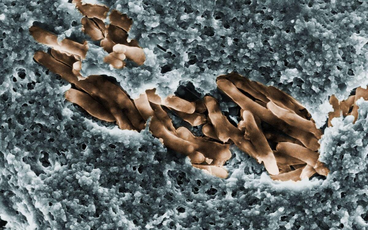 Mycobacterium ulcerans