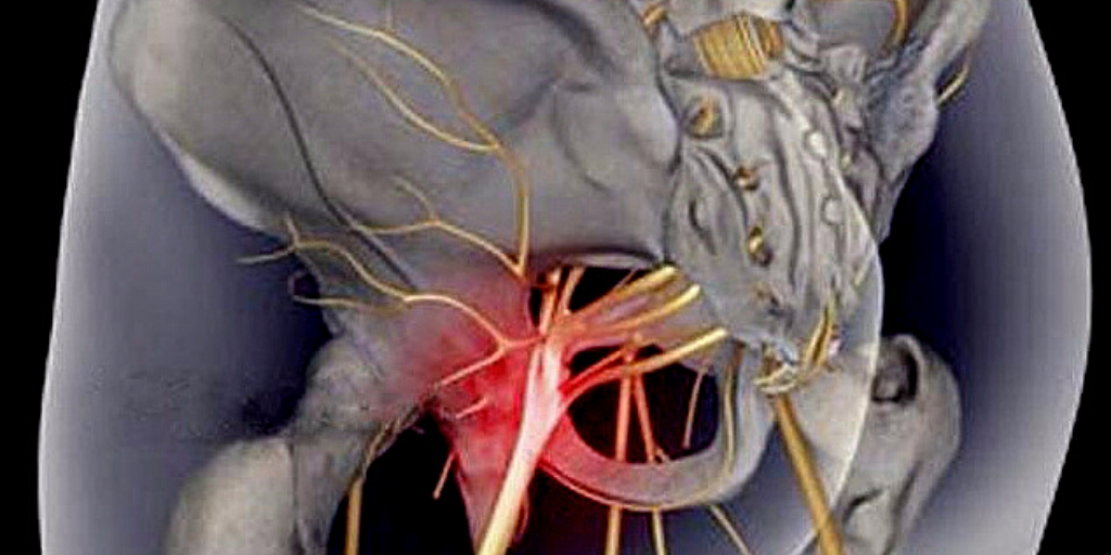 Фото седалищного нерва на человеке