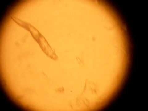 Клещ Демодекс под микроскопом