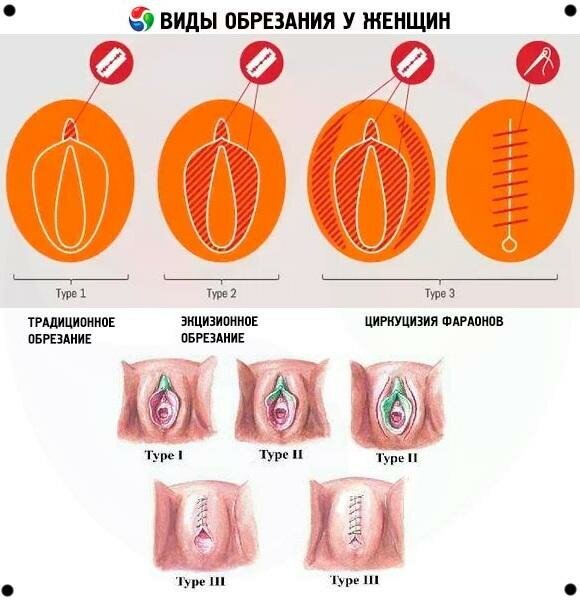 Женское обрезание в России - Афиша Daily