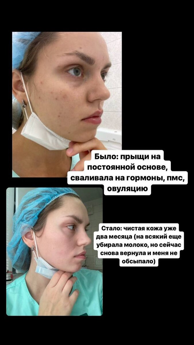 Как питание влияет на качество кожи