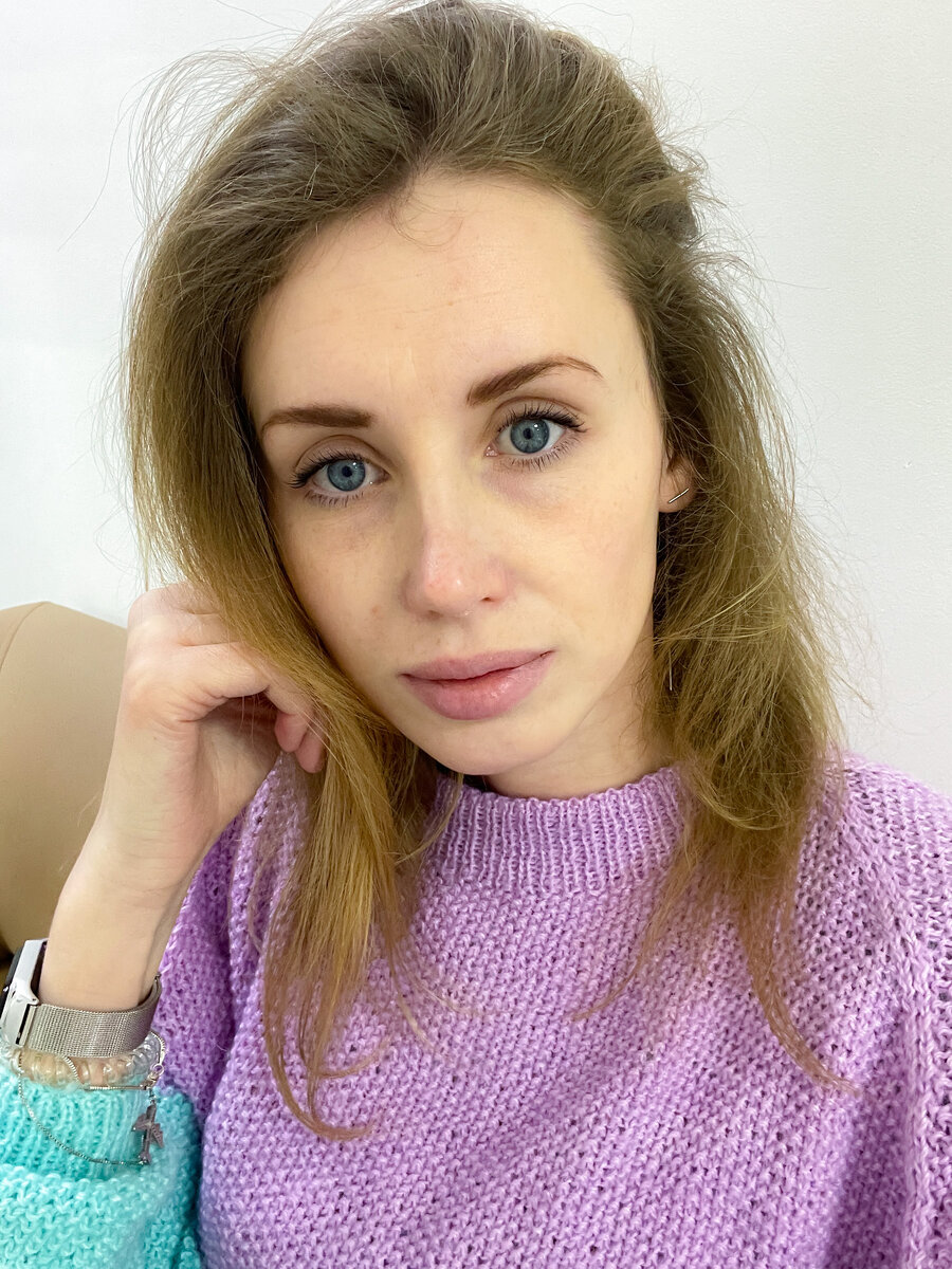 Фото с обычными зрачками