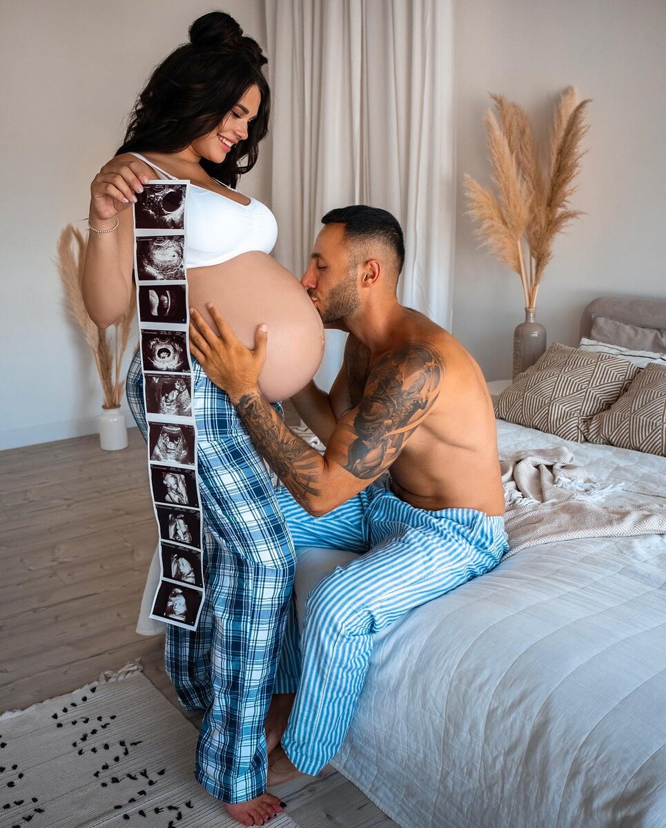    Ирина Пинчук сильно поправилась в беременностьСоцсети Ирины Пинчук