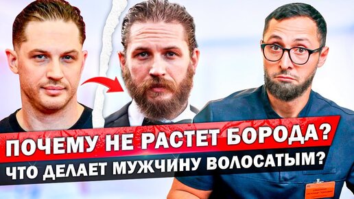 Что заставляет мужскую бороду расти? Средства и препараты для густой бороды