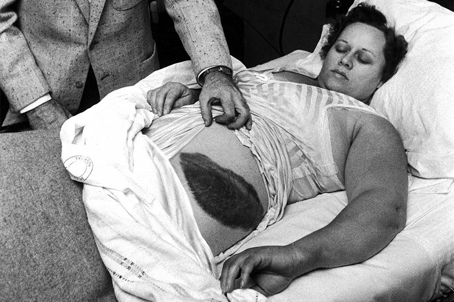 Энн Ходжес в госпитале штата Алабама 1954 год