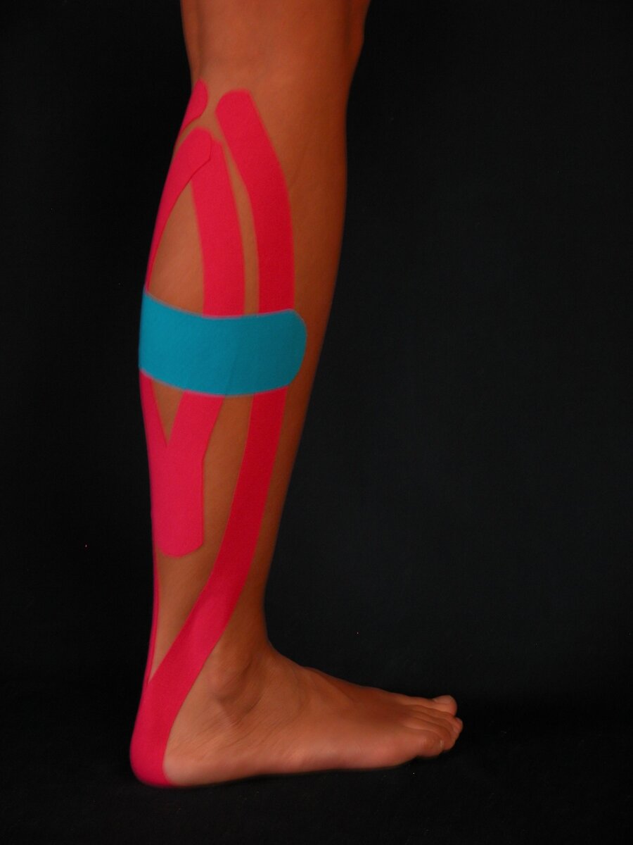 Тейпирование икроножной мышцы.