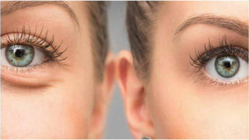 Фото взято из интернета