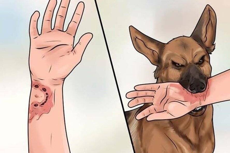 От укусов собак ежегодно в России страдают более 150 тыс. человек, многие погибают от бешенства после укуса инфицированного животного.-2