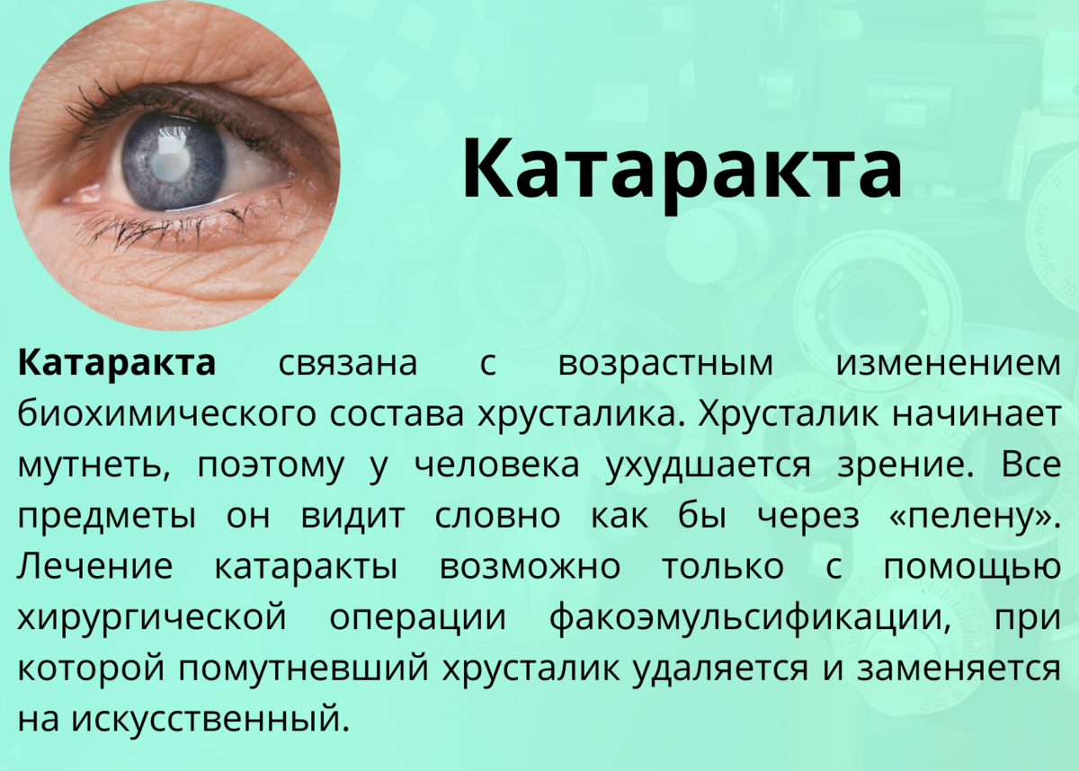 Какие заболевания глаз