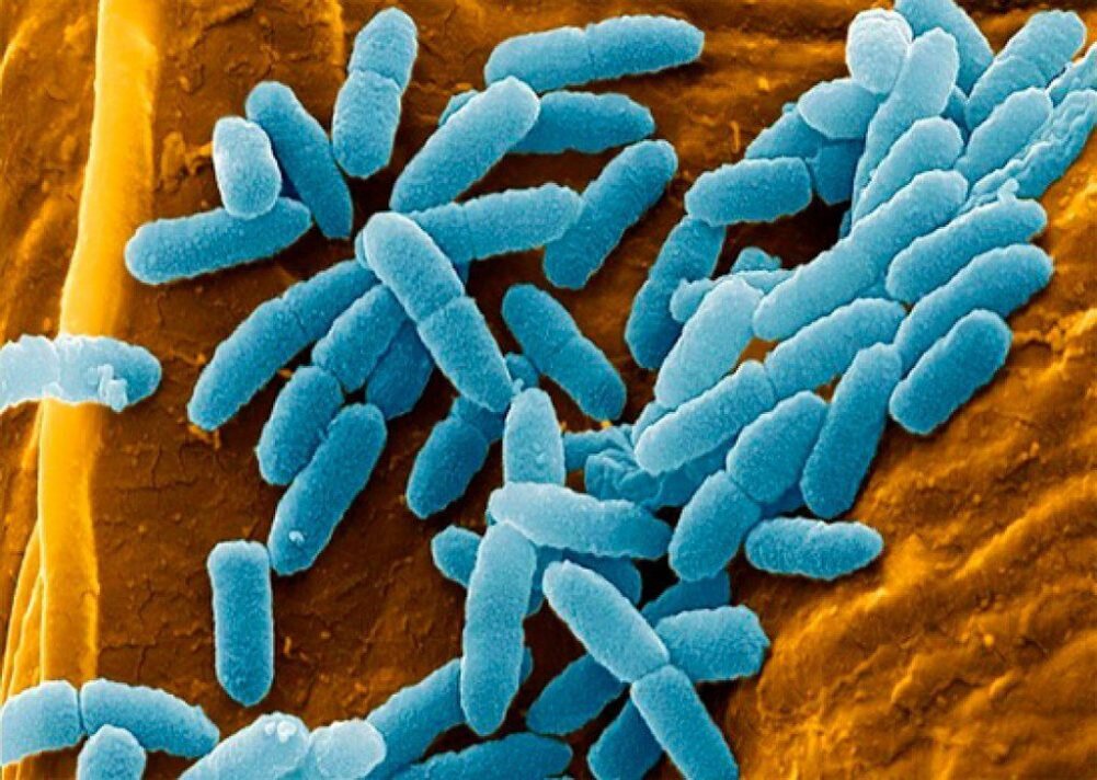 Бактерии белки. Псевдомонада aeruginosa. Пневмококки синегнойная палочка. Pseudomonas aeruginosa (синегнойная палочка).