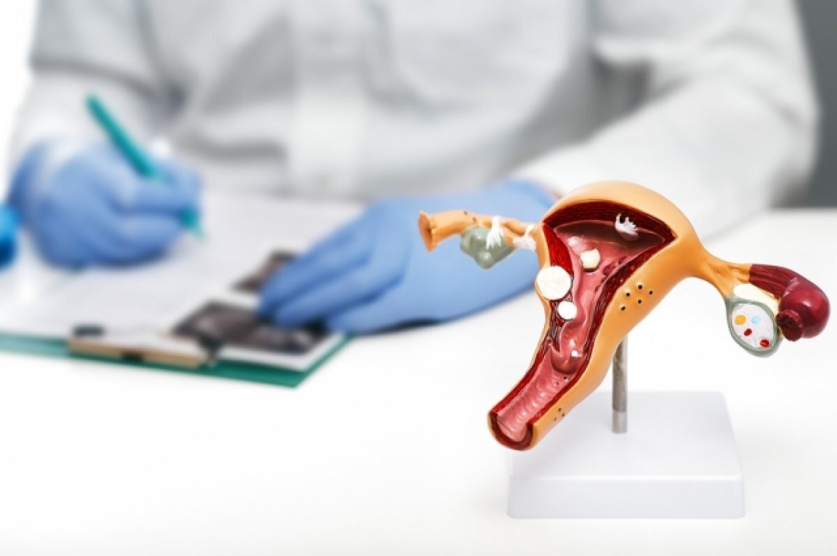 Полип не спит. Чем он опасен и почему может вырастать снова после ...