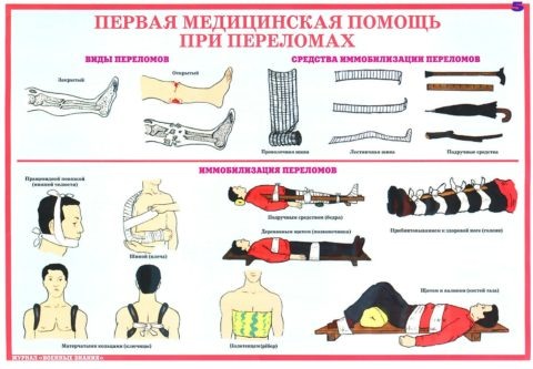  Оказание первой помощи проводится любыми подручными средствами
