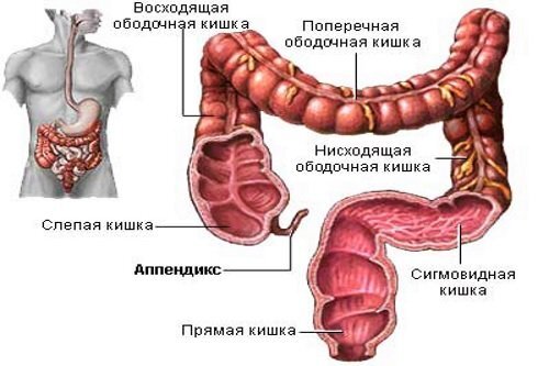 Лапароскопическая аппендэктомия