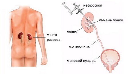 Как проходит приём уролога у женщин и у мужчин