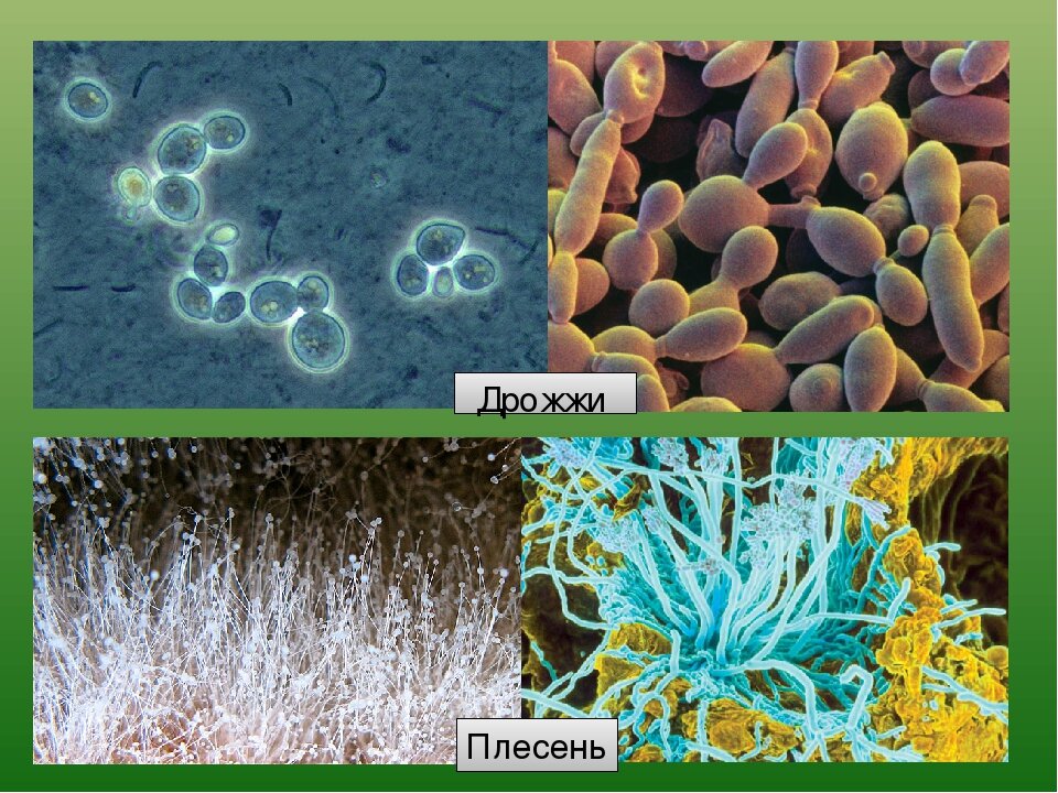 Организменные бактерии. Дрожжи и плесневые грибы микроорганизмов. Дрожжевые, мицелиальные грибы микробиология. Мицелиальные грибы дрожжи. Микроскопические грибы (плесени и дрожжи) это.