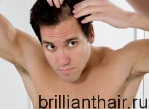 Как по другому называют облысение